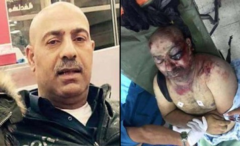 Ahmad-Izz-Halaweh-before-and-after